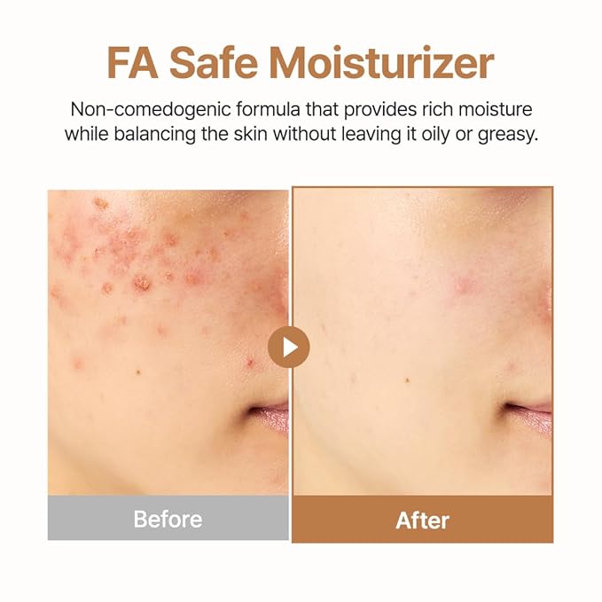 PURITO Post-Acne Moisturizer, Recovery & Glow Boost, Silicone-Free, Non-Comedogenic, Vegan, Korean Skincare, Oat In Calming Gel Cream, 3.38 fl oz / 100ml