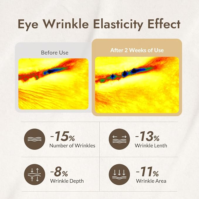 MIZON Snail Line Snail Repair Eye Cream, natural treatment, wrinkle treatment, fine line, hydrating, healthy skin, Korean skincare (0.84 oz)