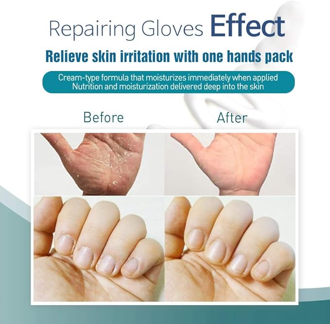 Epielle Intensive Repairing Hand Masks 6 Pairs, Deep Moisturizing Gloves for Dry, Cracked Hands, Repair with Coconut Oil & Milk Extract, Korean Skin Care, Spa Set, Self Care Gifts for Women