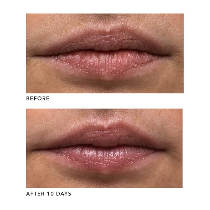 Algenist GENIUS Liquid Collagen Lip - Active Collagen Lip Treatment for Visibly Smoother Lips - Non-Comedogenic & Hypoallergenic Skincare (15ml)