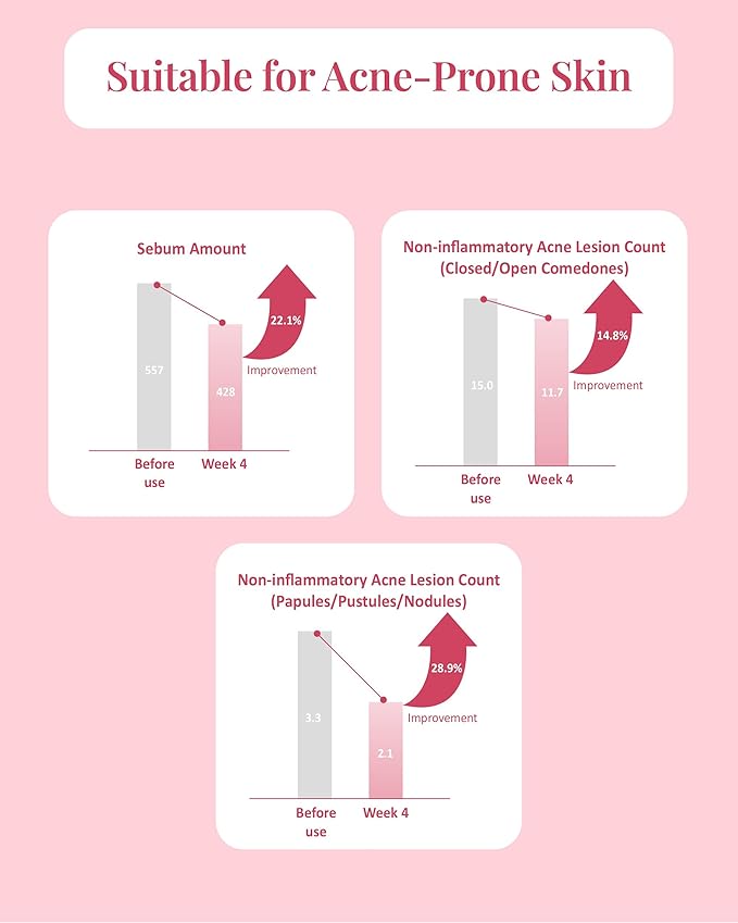 Pink Blemish Calming Serum (1.7fl oz) - Hydrating, Soothing Korean Skin Care for Sensitive Skin. Vegan Hyaluronic Acid, Niacinamide.