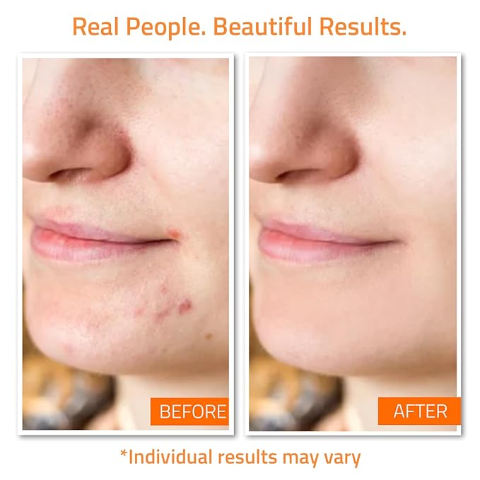 YEOUTH Skin Care Set: Vitamin C Face Wash, Toner, Vitamin C & Retinol Serum, Face Cream, Peel & Mask 7- Piece Skincare Gift Set for Teens, Women & Men