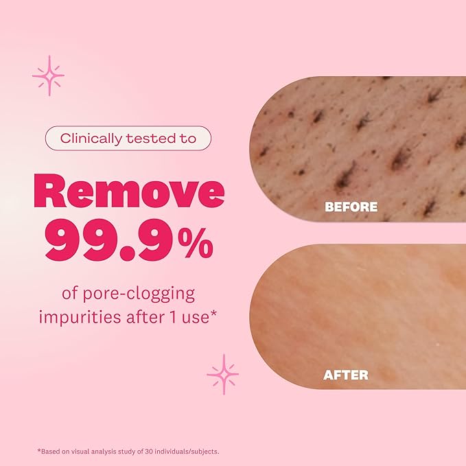 The Face Shop Rice Water Bright Foaming Facial Cleanser with Ceramide, Gentle Face Wash for Hydrating & Moisturizing, Vegan Face Cleanser, Makeup Remover, Korean Skin Care for All Skin Types, 300ml