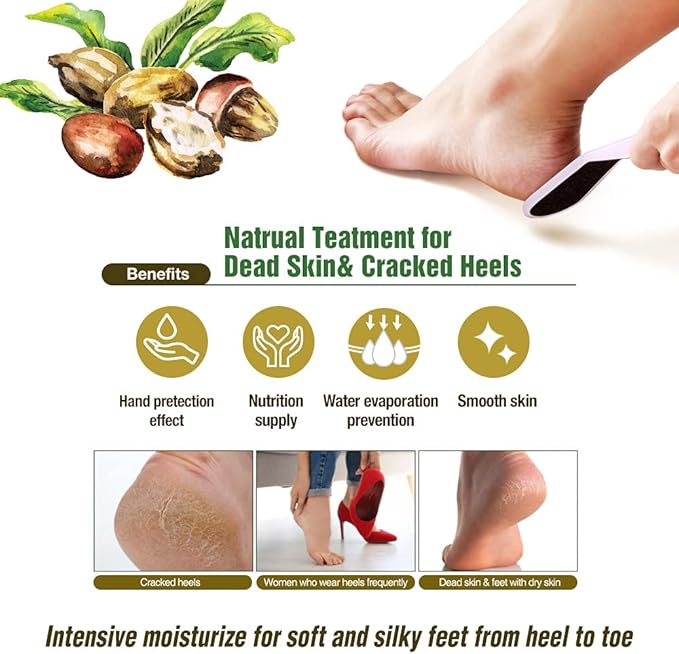 Epielle Hydrating Hand & Foot Masks 12 Pairs, Deep Moisturizing Socks & Gloves, Soften Dry Hands & Cracked Heels with Shea Butter & Jojoba Oil, Korean Skin Care, Foot Spa, Self Care Gifts for Women