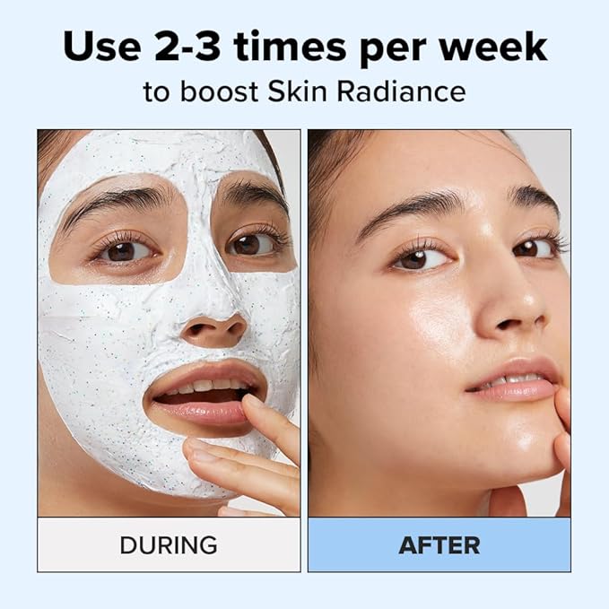 I DEW CARE Wash Off Face Mask - Cake My Day | With Hyaluronic Acid, Self Skin Care, Facial Treatment, Vegan, Cruelty-Free, Paraben-Free, Exfoliating, Deep Cleansing Detox, 3.38 Oz