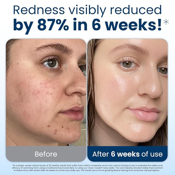 Clean Skin Club Clean Towels XL™️, 100% USDA Biobased Face Towel, Disposable Face Towelette, Eczema Association Accepted, Makeup Remover Dry Wipes, Ultra Soft, 150 Ct, 3 Pack