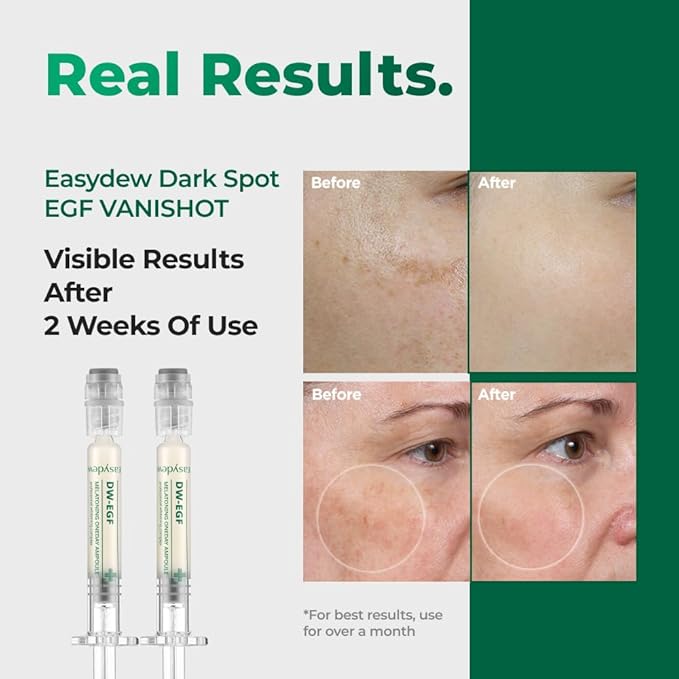 EASYDEW Dark Spot Correcting Serum for Uneven Skin Tone & Dull Skin – EGF, Niacinamide & Glutathione, Anti-Aging Formula, 30ml