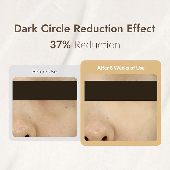 MIZON Snail Line Snail Repair Eye Cream, natural treatment, wrinkle treatment, fine line, hydrating, healthy skin, Korean skincare (0.84 oz)