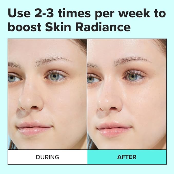 I DEW CARE Wash Off Face Mask - Chill Mo-Mint | Soothing Mask with Peppermint Leaf Extract, Korean Face Mask Skin Care for Face, 3.38 Oz