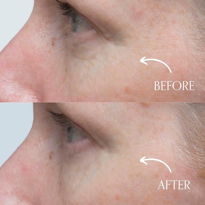 Radical Skincare Youth Infusion Serum - Evens Skin Tone, Reduces Fines Lines & Wrinkles - Hydrates & Smooths Skin - For All Skin Types Including Sensitive Skin - Paraben & Cruelty Free (1 fl oz)