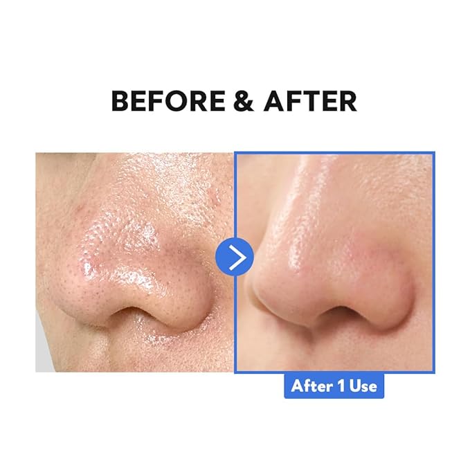 TIRTIR Hydro Boost Enzyme Cleansing Balm (1.69 Ounce (Pack of 1))