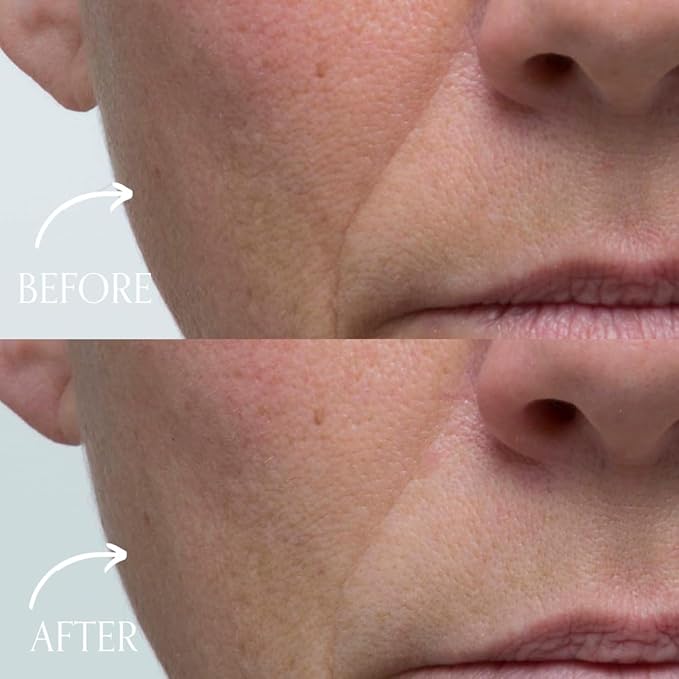 Radical Skincare Youth Infusion Serum - Evens Skin Tone, Reduces Fines Lines & Wrinkles - Hydrates & Smooths Skin - For All Skin Types Including Sensitive Skin - Paraben Free (1 fl oz, 2 Pack)