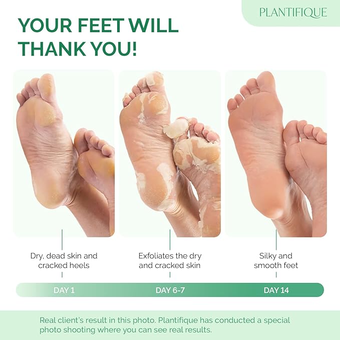 PLANTIFIQUE Foot Peeling Mask 1 Pack | Dermatologically Tested Repairs Heels & Removes Dry Dead Skin for Baby Soft Feet | Exfoliating Foot Peel Mask for Dry Cracked Feet | Peach