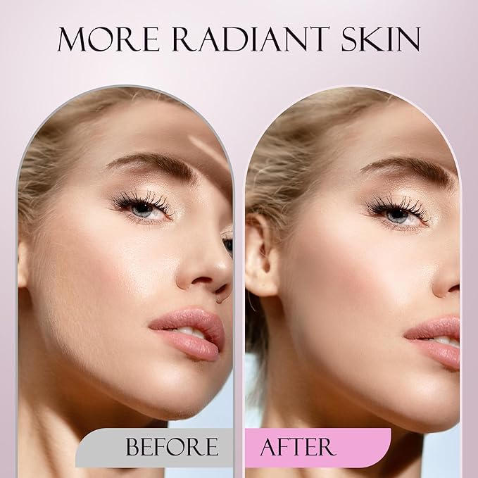 Sonic Dermaplane Razor for Women Face, Dermaplaning Tool for Face, Facial Hair Removal for Women, Sonic Edge Technology, Peach Fuzz with 16 Replaceable Blades(White)