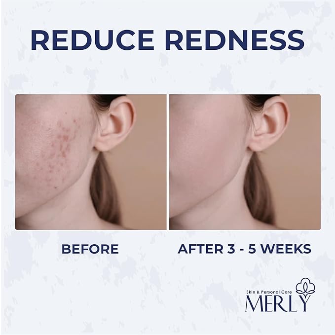 Merly™ Disposable Face Towels, Facial Wipes Towelettes Disposable, Towels Cloth For Cleaning Face, 10"x12", 50 Counts, 1 pack, Ultra-Soft, Super Absorbent, Biodegradable