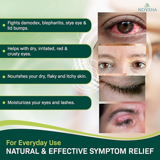 Demodex Eyelid Cleanser Foam | Extra Strength Tea Tree Oil Formula | Daily Face Wash For Eyelash, Demodex, MGD, Stye Eyes, Eye Irritations & Skin Dryness, 3.38 fl oz (100ml)