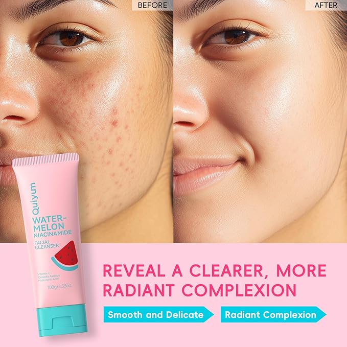 Foaming Face Wash, Watermelon Extracts, Niacinamide, Vitamin C, Hyaluronic Acid, Centella Asiatica, Exfoliating, Pore Minimizer, Hydrate, Glow, 3.53 Oz