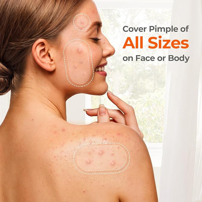TKTK 443 Count Pimple Patches for Face, Hydrocolloid Acne Patch Bulk, Acne Stickers for Covering Cheeks, Forehead, Chin Blemishes Zit Breakouts for All Skin Types (Dots, Strip, Contoured 5 Sizes)