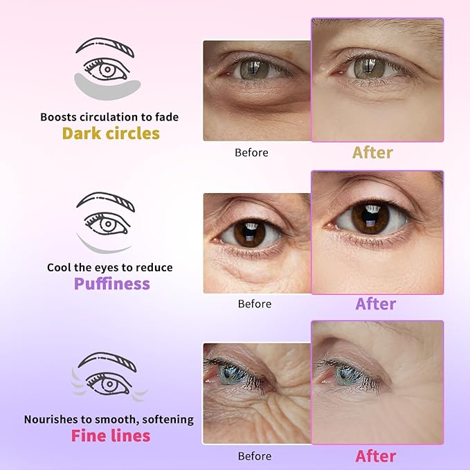 Under Eye Patches for Dark Circles, Puffiness, Fine Lines, Eye Mask Set with Retinol, 24K Gold, Caffeine, Gel Mask for Birthday & Spa Party Favors, Skincare Gift for Women & Men, 24 Pairs