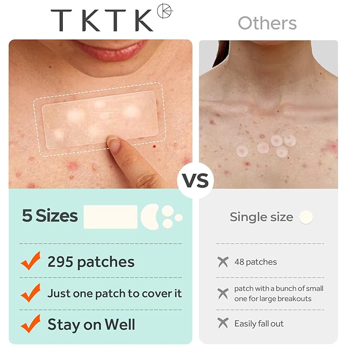 TKTK Large Pimple Patches for Face, 68 x 27 mm XL Hydrocolloid Bandages, Big Acne Patches for Body, Forehead, Chin, Nose, Chest and Back Blemish Zit Breakouts (Strip, Contoured, Dot 5 Sizes 295 Count)