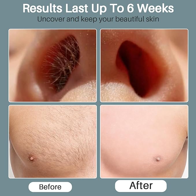 BLITZWAX Back and Nose Waxing Kit for Men, Hard Wax Warmer for Brazilian, Body and Face, At Home Hair Removal Kit, Beginner Friendly, Quick Heating, 93 Accessories, Blue Spruce