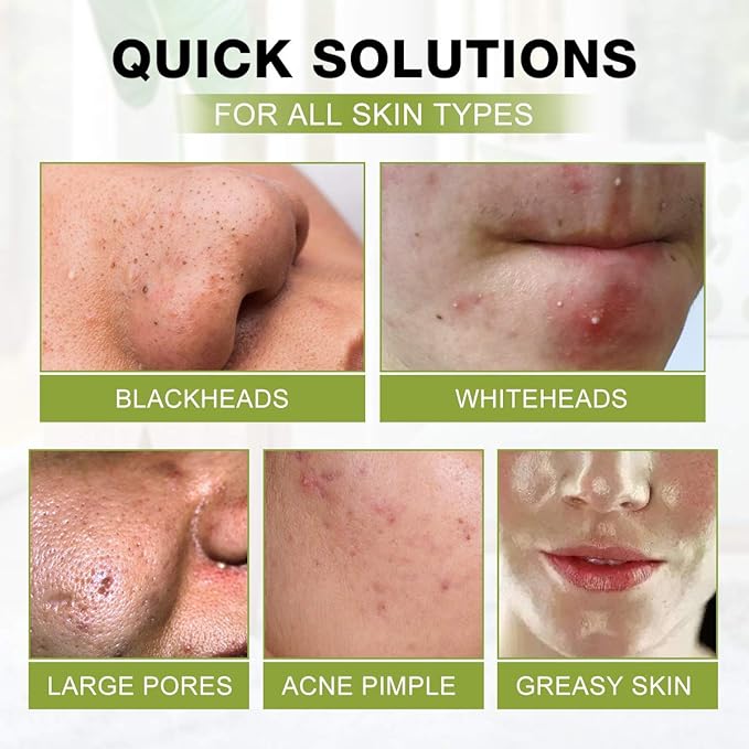 SHVYOG Blackhead Peel Off Face Mask, 3-in-1 Blackhead Remover Mask with Brush & Tea Tree Oil Serum, Charcoal Mask for Deep Cleansing Dirts, Pores, Skin Oil (100g+30ml)