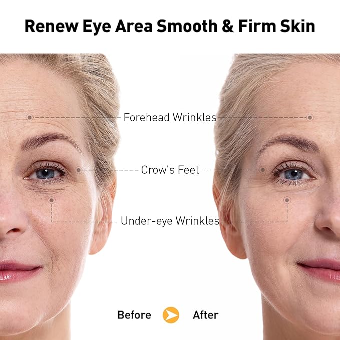 Eye Cream for Anti-Aging & Wrinkles – Firming, Hydrating & Repairing Eye Serum with Retinol, Niacinamide, Hyaluronic Acid, Vitamin E & Bifida Ferment Lysate, 0.7 Fl Oz (Pack of 2)