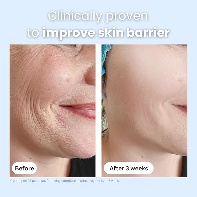 Organic Bee Venom + Manuka Day Barrier Face Moisturizer | Hydrating, Anti-Wrinkle, Collagen Booster | 2.5 month supply, 2oz/60ml | Made in New Zealand