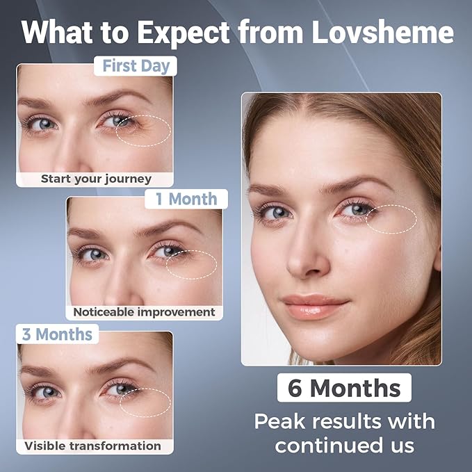 Red Light Therapy for Face – Wireless Red Light Therapy Mask LED Face Mask Light Therapy with 320 LEDs, 4 Modes, Skin Rejuvenation, Ideal Beauty Gift for Women & Men