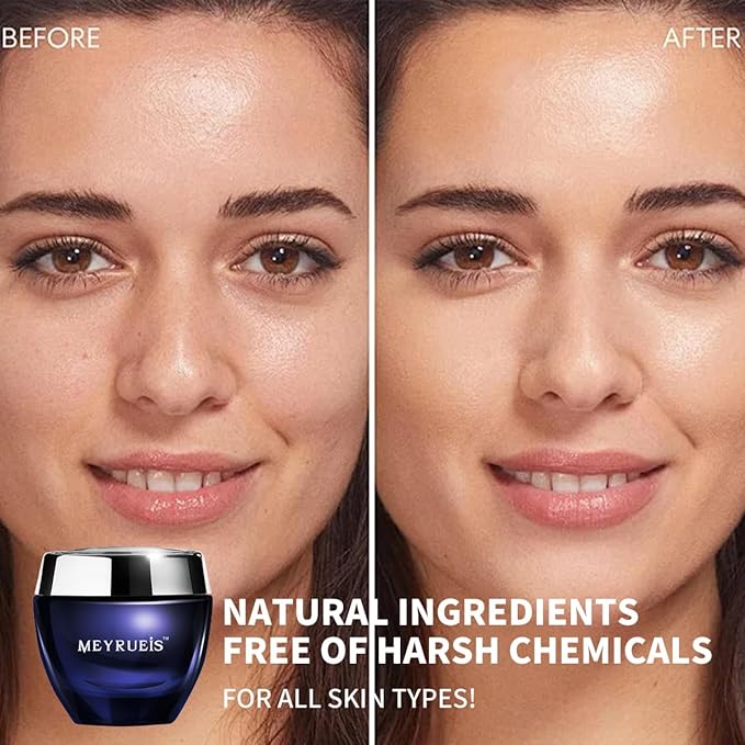 MEYRUEIS Anti-Aging Moisturizer Face Cream, NAD+, Moisturize Without Oil, Fast-Absorbing, Deeply Nourishing, For All Skin Types, 0.35 Fl Oz