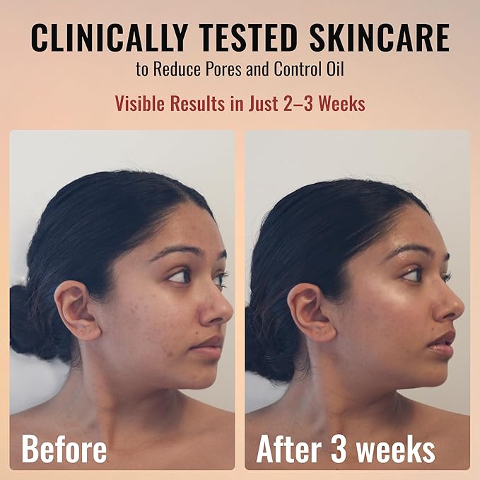 ADM Anti Aging Pure Retinol Serum For Face with Niacinamide - Resurfacing, Smoothing Fine Lines, Wrinkles, Acne Scars - Moisturizing Facial Skincare Treatment for Sensitive Skin - 1oz