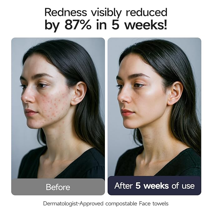 ECOLOOK Disposable Face Towel XL-10"x12" Upgraded Thick Facial Towels, Ultra Soft Clean Face Towels Disposable, 60 Count & 90 GSM, Ideal for Sensitive Skin-1 PACK