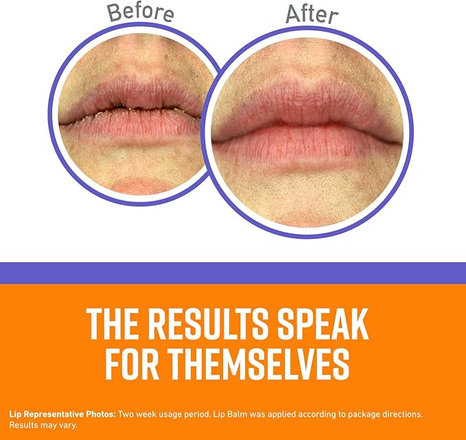 O'Keeffe's Night Treatment Combo Pack Including Working Hands Night Treatment Hand Cream, Healthy Feet Night Treatment Foot Cream and Lip Repair Night Treatment Lip Balm; Gift Idea