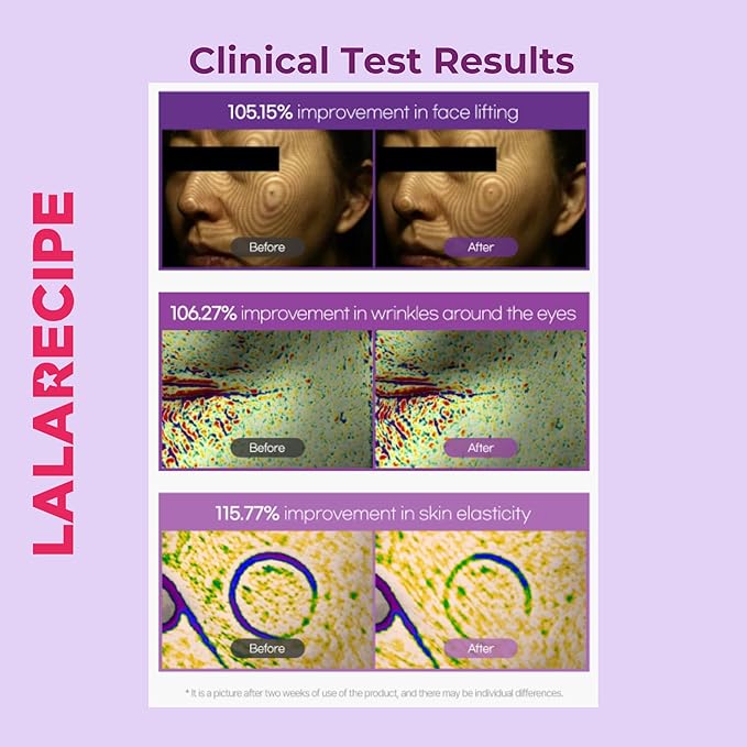 Bakuchiol First Essence – Hydrating Milky Korean Toner with Retinol Liposome, Shea Butter & Peptides – Vegan Skincare for Wrinkle Care & Elasticity (5.24 fl oz)