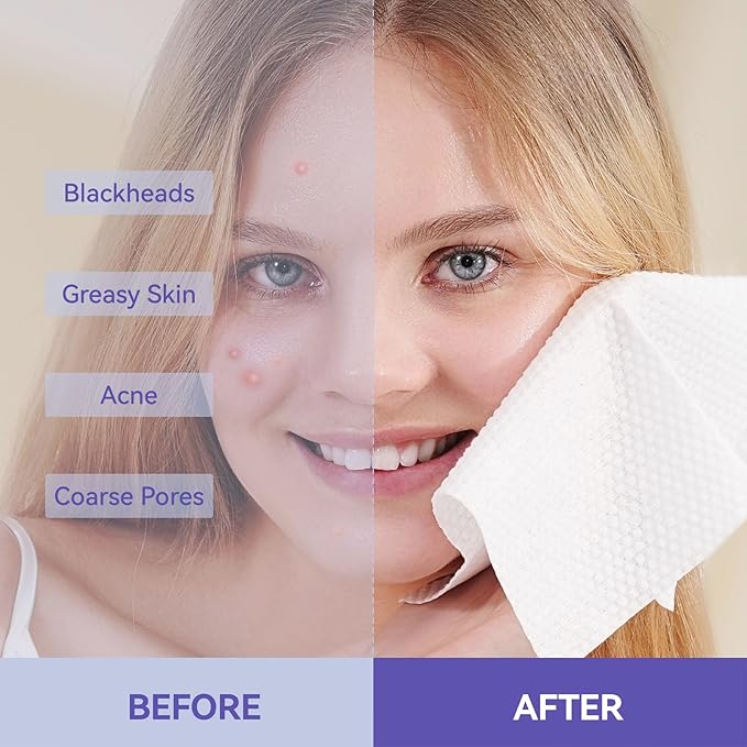 Disposable Face Towels, 10"×12" XL Face Towelette Disposable, Soft Makeup Remover Dry Wipes, Thick Facial Tissue for Women Cleansing, Skin Care, 50 Count (4 Pack)