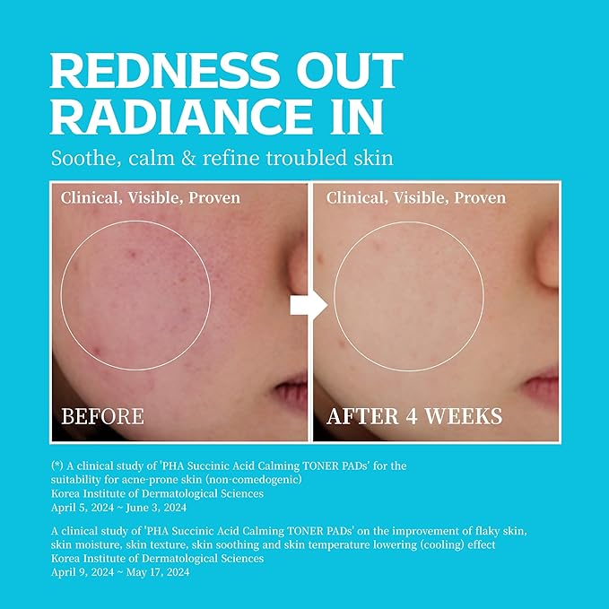 Re.SPN PHA Succinic Acid Calming Toner Pads – Daily Exfoliating, Hydrating and Soothing with CICA, Caffeine, Non-comedogenic, Vegan, Glass Skin, K-Beauty (70 Count)