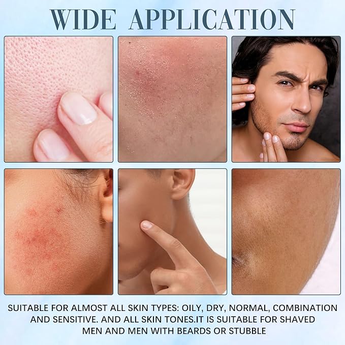 3pcs Organic Acne & Redness Killer, Acne and Redness Relief Balm, Organic Acne Remove Set, Acne killer Skin Care Set