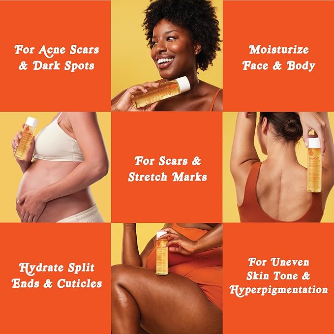 Bio-Oil Natural Skincare Oil Serum, Face and Body Moisturizer with Chamomile, Rosehip, and Lavender Oil, for Scars, Stretch Marks, Sensitive Skin, All Skin Types, 0.85 Oz, Pack of 3