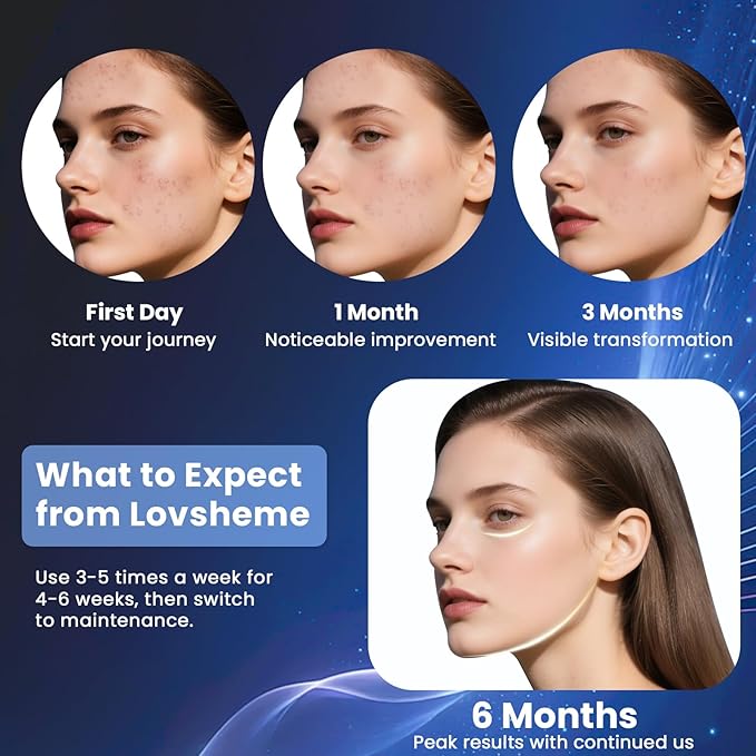 Red Light Therapy for Face – Wireless Red Light Therapy Mask LED Face Mask Light Therapy with 320 LEDs, 3 Modes, Skin Rejuvenation, Anti-Aging Skincare Ideal Beauty Gift for Women & Men