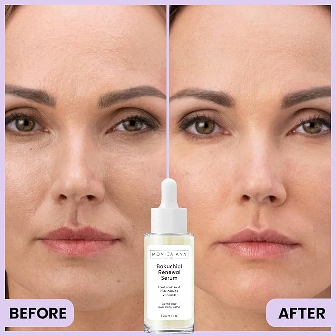 Bakuchiol Serum – Retinol Alternative with Hyaluronic Acid, Niacinamide & Vitamin C – Anti-Aging, Brightening, Hydrating Face Serum for Fine Lines & Wrinkles (1.7 fl oz)