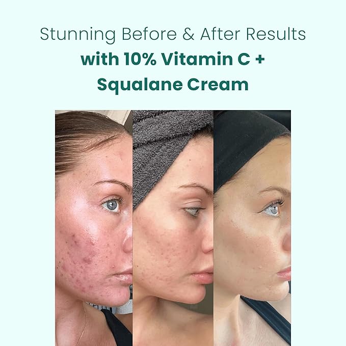 Gin Amber Beauty - Vitamin C (10%) + Squalane Repair Cream - Face Moisturizer - Skin Cream - Dark Spot Corrector - Primer (1 fl oz - 30ml)