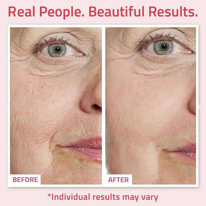 YEOUTH Retinol Serum for Face with Hyaluronic Acid & Vitamin E, Hydrating Retinol Face Serum, Skin Care Suitable for All Skin Types 2oz