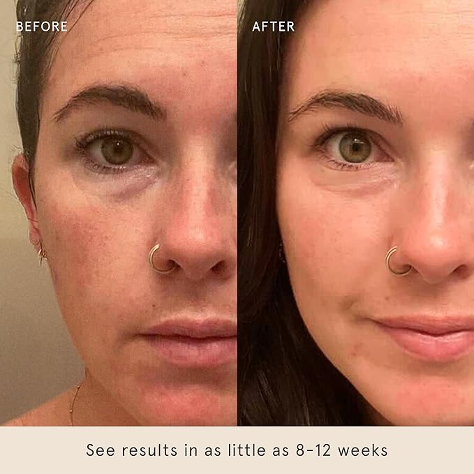 Barefaced Serum Duo - Liquid Gold & Overachiever to Hydrate, Improve Skin Firmness, & Strengthen Skin Barrier