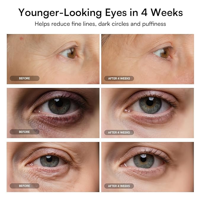 Red Light Therapy Eye Mask for Under Eye Treatment & Rejuvenation - Skincare Device for Dark Circles, Wrinkles, Forehead Lines, Crow's Feet