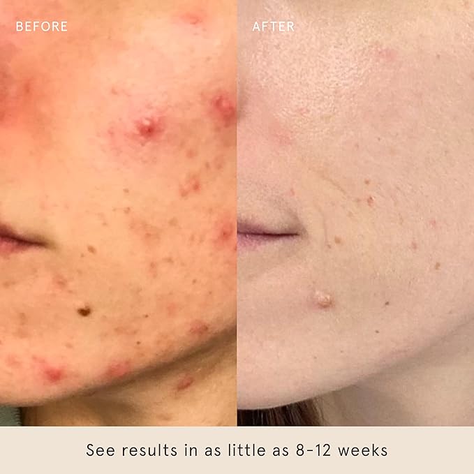 Barefaced Toning Pads II (60 Count) Exfoliating and Resurfacing Face Pads w/ 5% Glycolic Acid & Salicylic Acid, Helps with Brightening & Cleansing Skin, Clears Pores, Reduces Fine Lines and Wrinkles