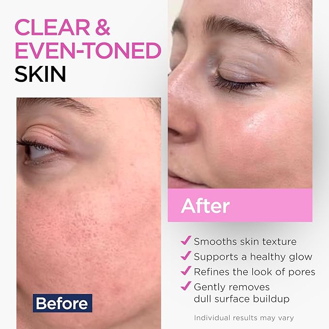 Glycolic Acid Serum for Face 15% - Extra Large Size (2 Oz) - Advanced Formula to Support Skin Radiance, Addressing Uneven Tone & Fine Lines