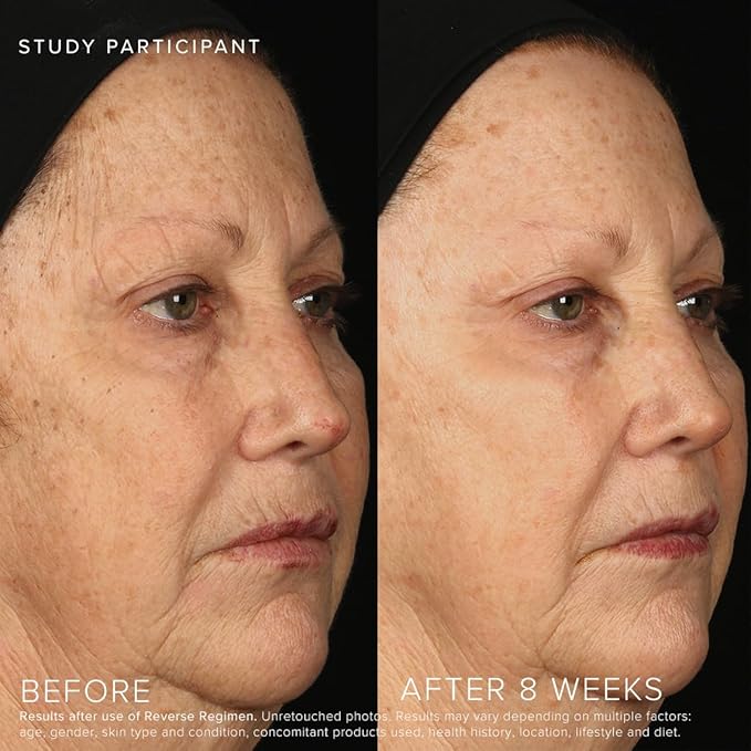 Rodan + Fields Reverse Regimen: Cleanser, Toner, Lotion SPF 50, & Treatment | Daily Moisturizer | Contains Vitamin C & Retinol | Skincare Sets & Kits | Face Wash for Women | Self Care