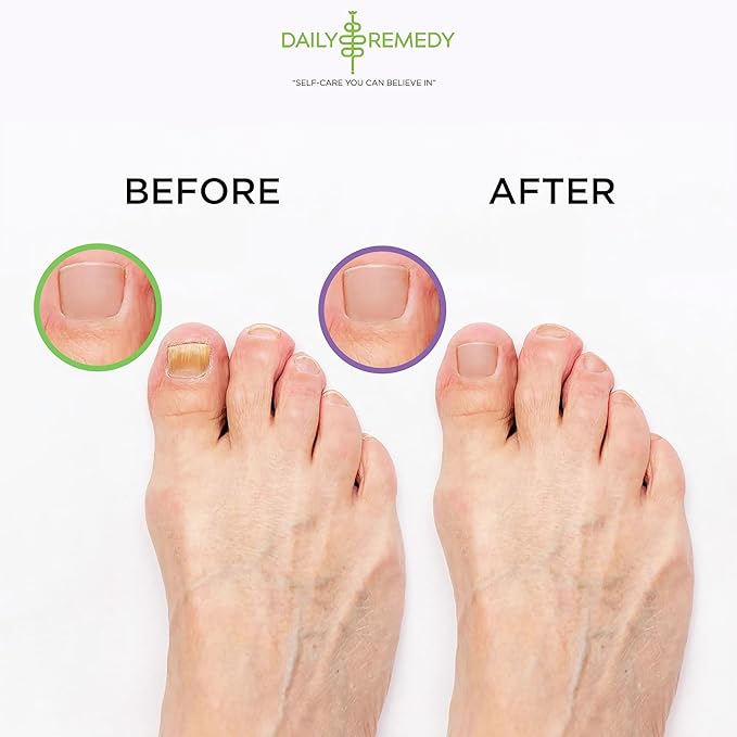 DAILY REMEDY 4-Pack - 2 Extra Strength Tea Tree Oil & 2 Calming Lavender Foot Soak Set - Made in USA - Soothes Sore Tired Feet, Athletes Foot, and Softens Calluses - 64 oz