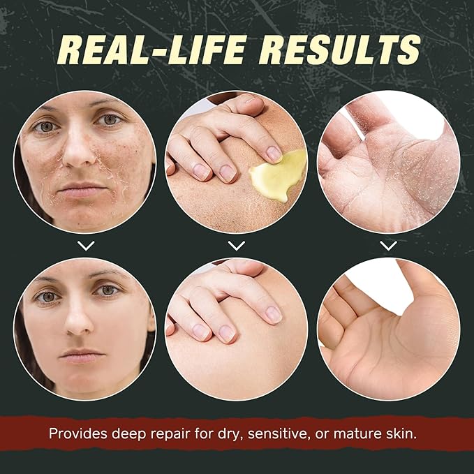 2 Pack Handmade Beef Tallow with Frankincense and Castor Oil Face Balm, 100% Grass-Fed Tallow for Skin Care, Face & Body Moisturizer for Sensitive Skin & Dry Skin Age Defying, Natural Lotion