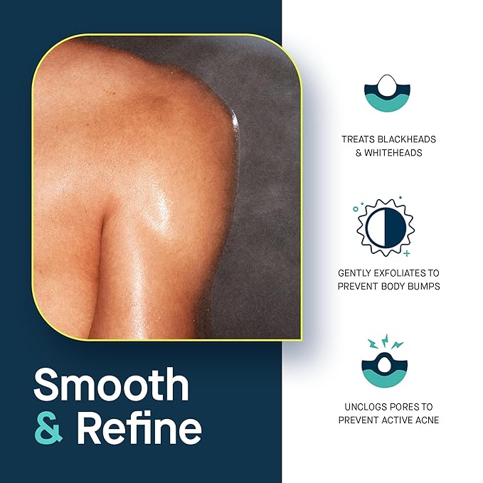 SLMD by Dr. Pimple Popper | Salicylic Acid Body Spray | Exfoliating Body Acne Treatment to Treat and Prevent Blackheads and Whiteheads | 3 fl. oz.